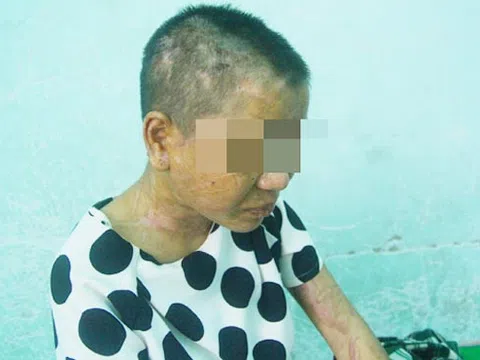 Cô gái bị tra tấn dã man ở Gia Lai kể lại hành trình thoát khỏi “địa ngục trần gian”